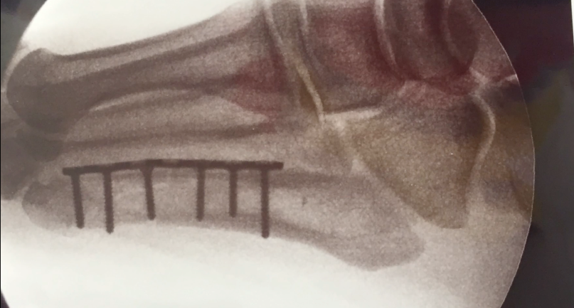 axl-rose-fuss-screenshot