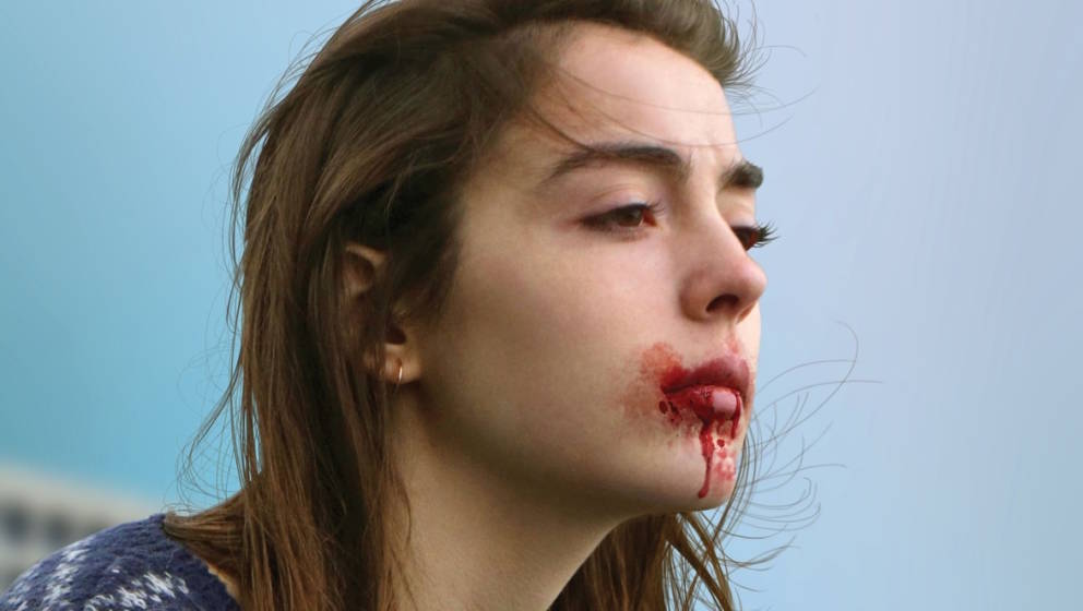 Blut an den Lippen: Szene aus „Raw“