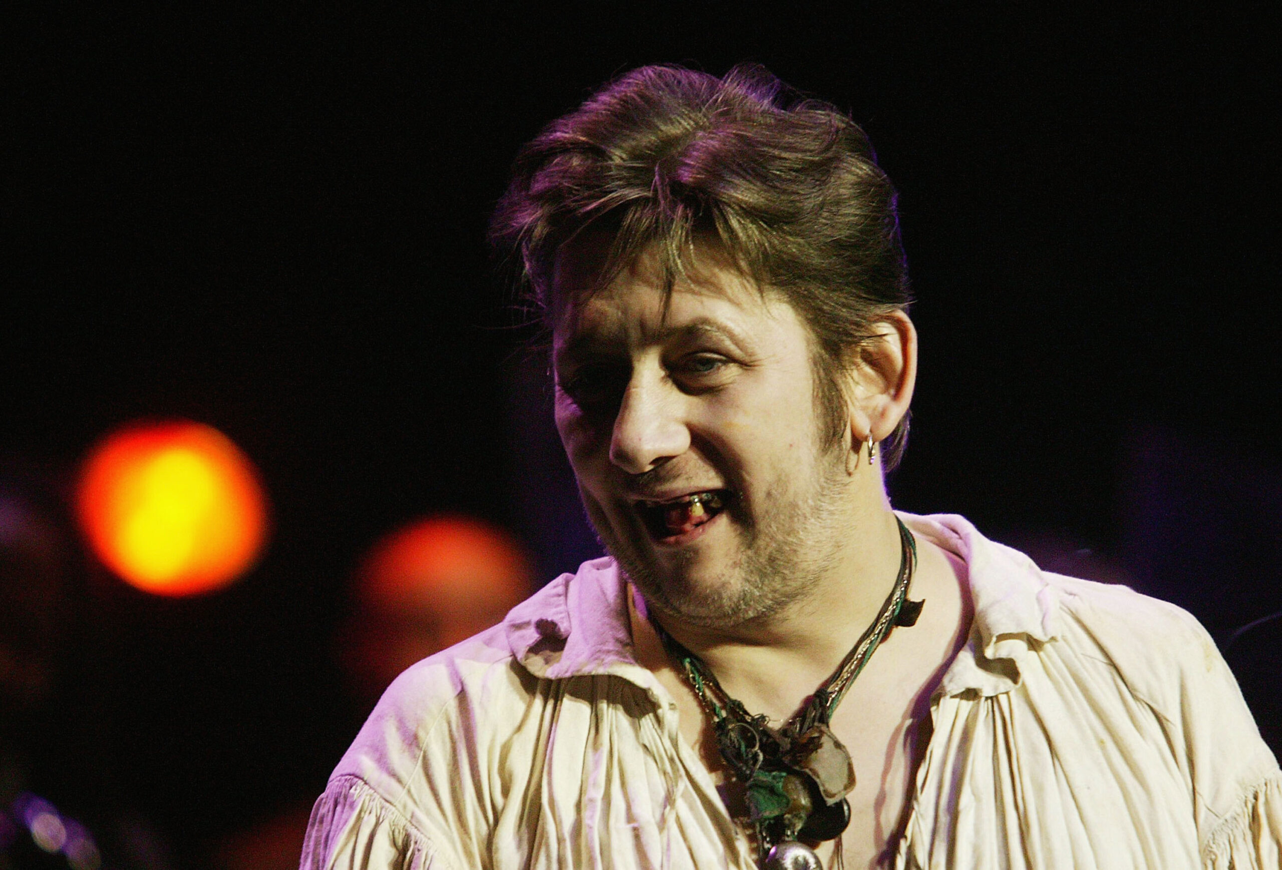 MacGowan war bekannt für seine mangelnde Zahnhygiene – viele Jahre hatte er gar keine Zähne.